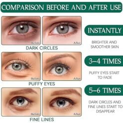 Vorher-Nachher-Vergleich: Augen mit weniger Augenringen, Schwellungen und Fältchen